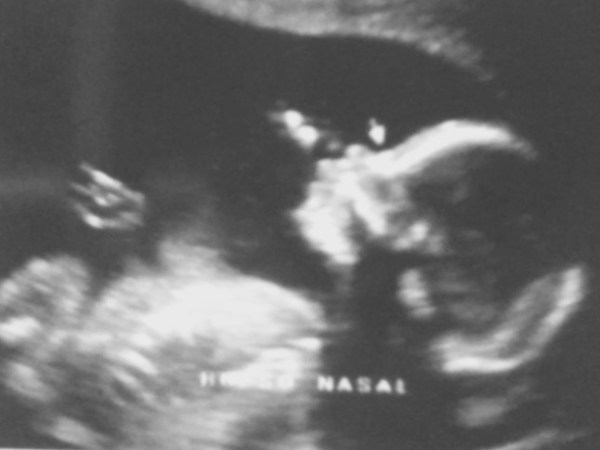 La Búsqueda y Bienvenida de&nbsp;Luciano